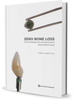 Zero bone loss
