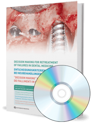 Decision making for retreatment of failures in dental medicine. Volume 4