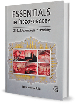 Essentials in Piezosurgery