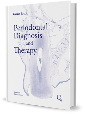 Periodontal Diagnosis and Therapy